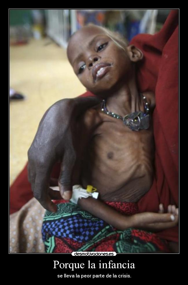 Porque la infancia - 
