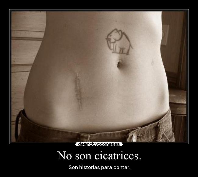 No son cicatrices. - Son historias para contar.