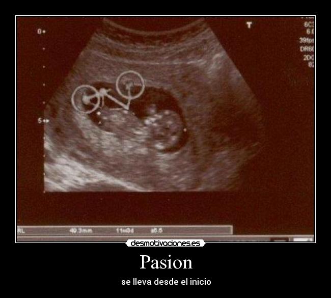 Pasion - se lleva desde el inicio