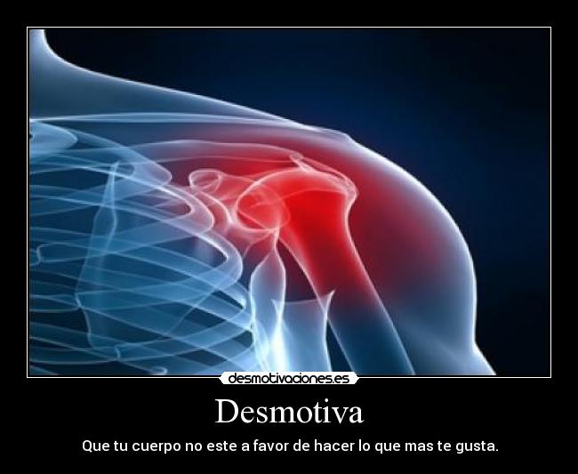 carteles cuerpo lesion desmotiva desmotivaciones