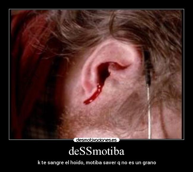 deSSmotiba - k te sangre el hoido, motiba saver q no es un grano