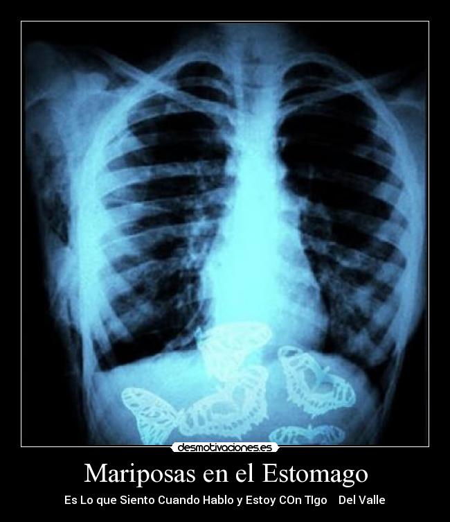 Mariposas en el Estomago -