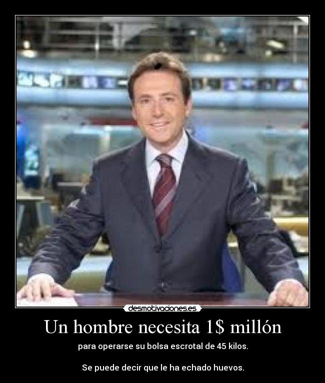 Un hombre necesita 1$ millón - para operarse su bolsa escrotal de 45 kilos.
Se puede decir que le ha echado huevos.