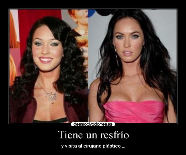 Tiene un resfrío - y visita al cirujano plástico ...