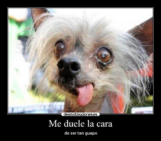 Me duele la cara - de ser tan guapo