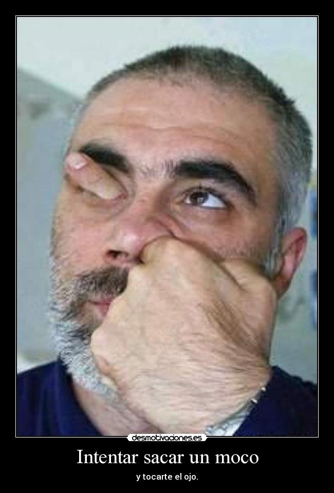 Intentar sacar un moco - y tocarte el ojo.