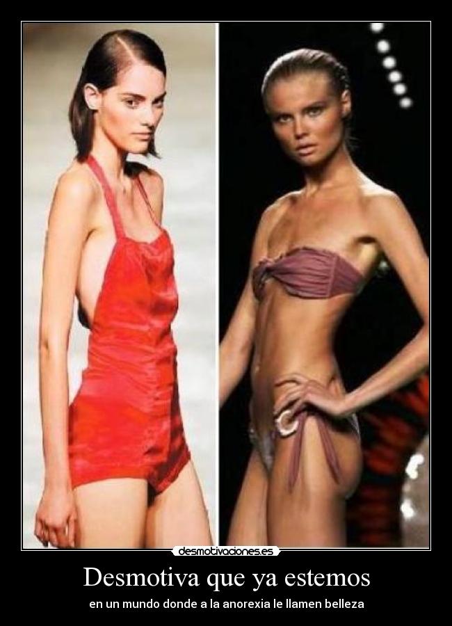 Desmotiva que ya estemos - en un mundo donde a la anorexia le llamen belleza