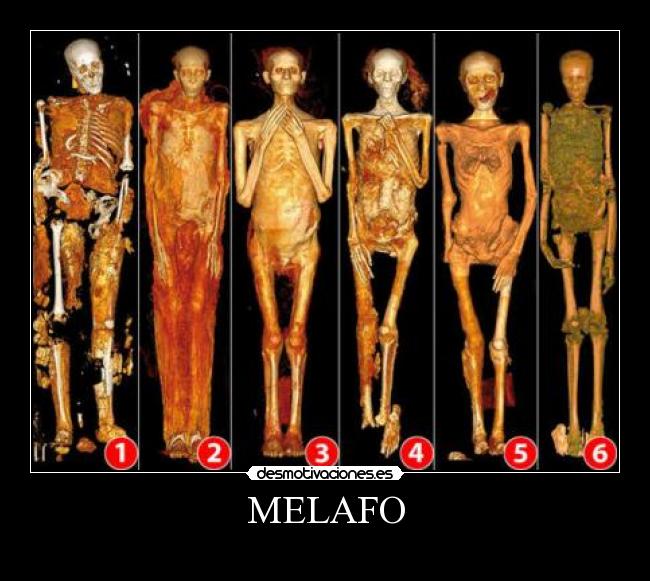 MELAFO - 