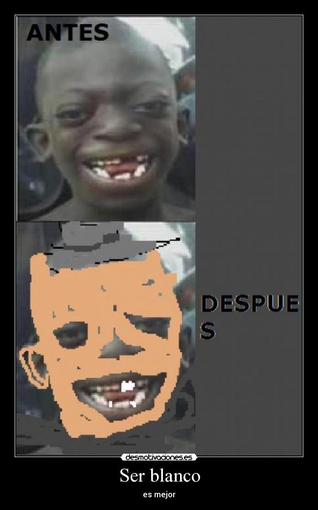 Ser blanco - es mejor