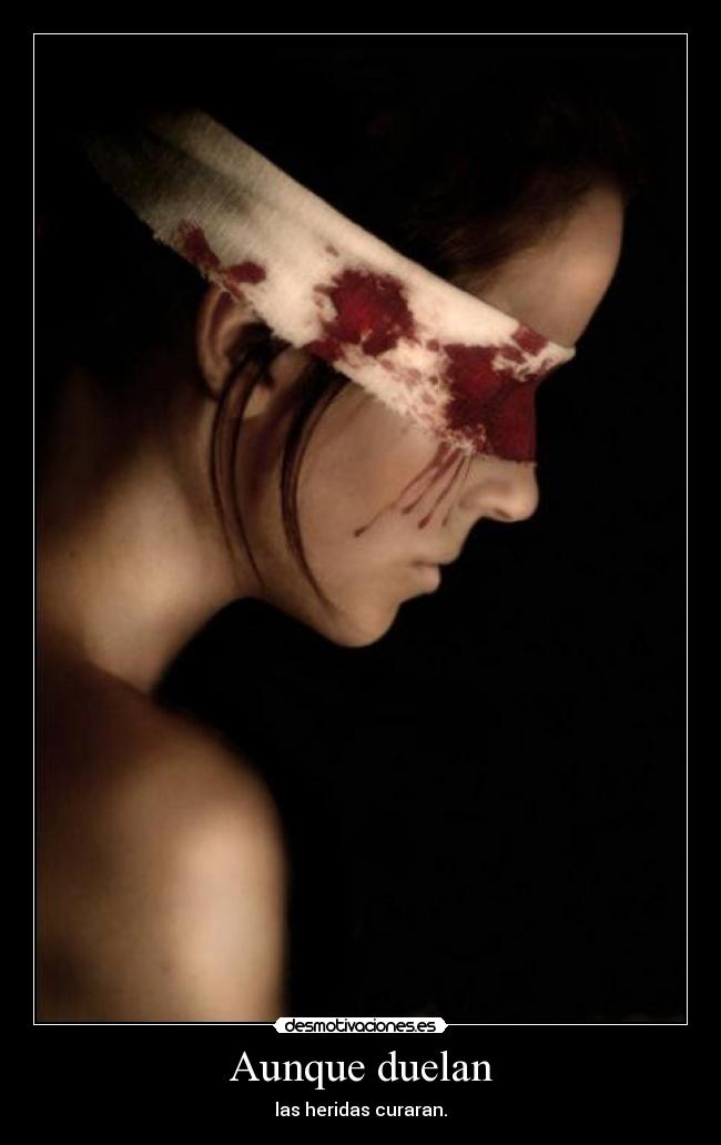 Aunque duelan -