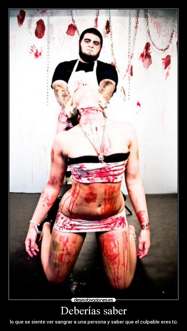 Deberías saber - lo que se siente ver sangrar a una persona y saber que el culpable eres tú.