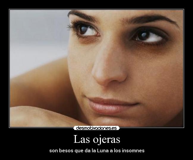 Las ojeras - 