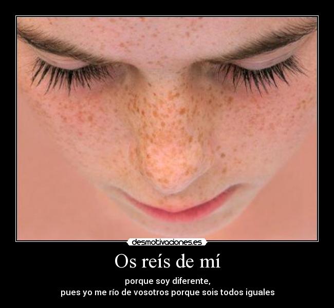 Os reís de mí - porque soy diferente,
pues yo me río de vosotros porque sois todos iguales
