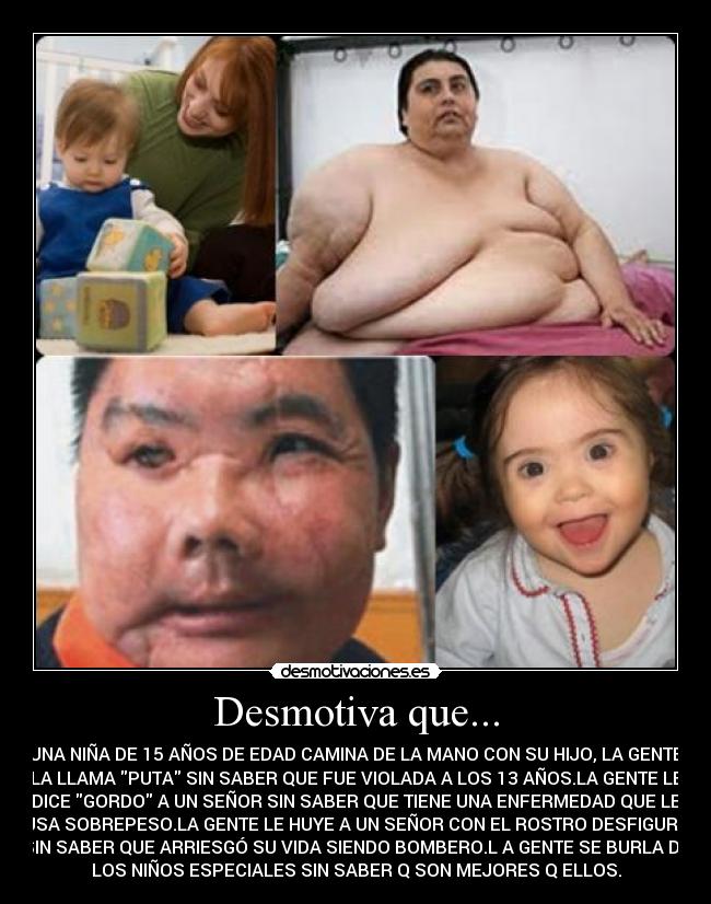 Desmotiva que... - UNA NIÑA DE 15 AÑOS DE EDAD CAMINA DE LA MANO CON SU HIJO, LA GENTE
LA LLAMA PUTA SIN SABER QUE FUE VIOLADA A LOS 13 AÑOS.LA GENTE LE
DICE GORDO A UN SEÑOR SIN SABER QUE TIENE UNA ENFERMEDAD QUE LE
CAUSA SOBREPESO.LA GENTE LE HUYE A UN SEÑOR CON EL ROSTRO DESFIGURADO
SIN SABER QUE ARRIESGÓ SU VIDA SIENDO BOMBERO.L A GENTE SE BURLA DE
LOS NIÑOS ESPECIALES SIN SABER Q SON MEJORES Q ELLOS.