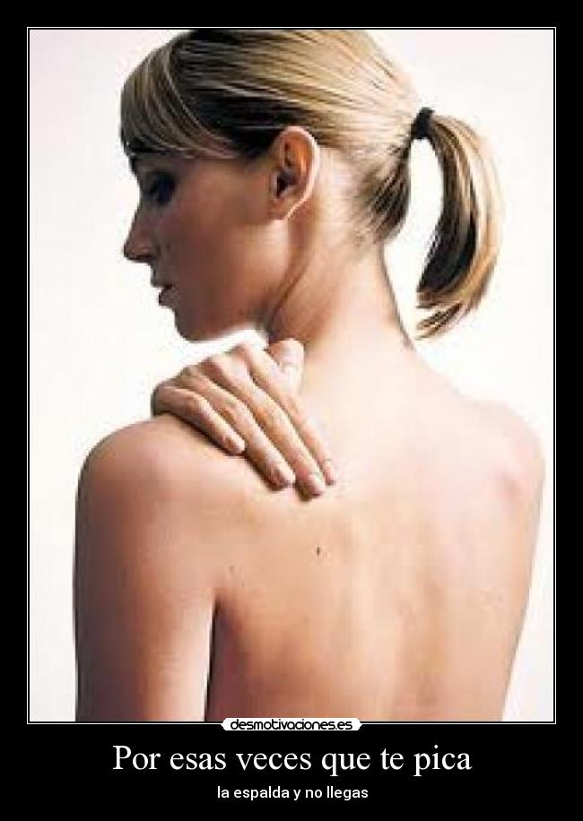Por esas veces que te pica -