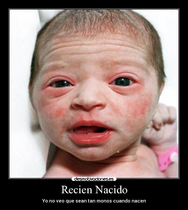 Recien Nacido - Yo no veo que sean tan monos cuando nacen