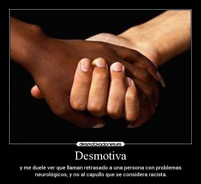 Desmotiva - y me duele ver que llaman retrasado a una persona con problemas
neurológicos, y no al capullo que se considera racista.