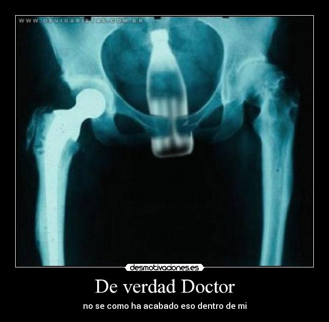 De verdad Doctor - no se como ha acabado eso dentro de mi