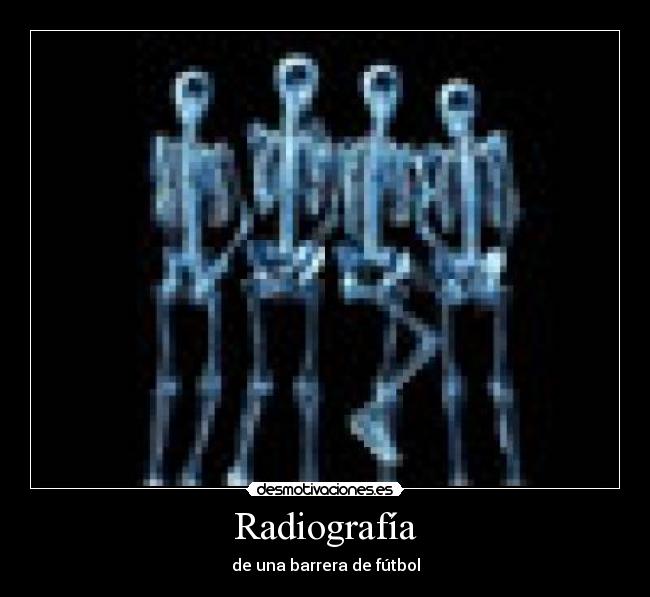 Radiografía - de una barrera de fútbol