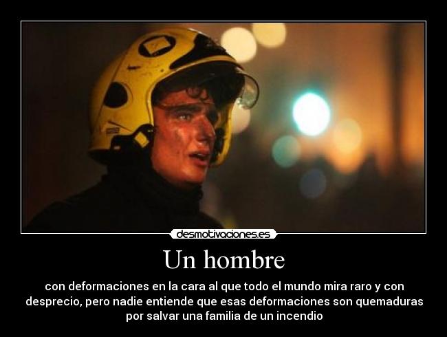 Un hombre - con deformaciones en la cara al que todo el mundo mira raro y con
desprecio, pero nadie entiende que esas deformaciones son quemaduras
por salvar una familia de un incendio