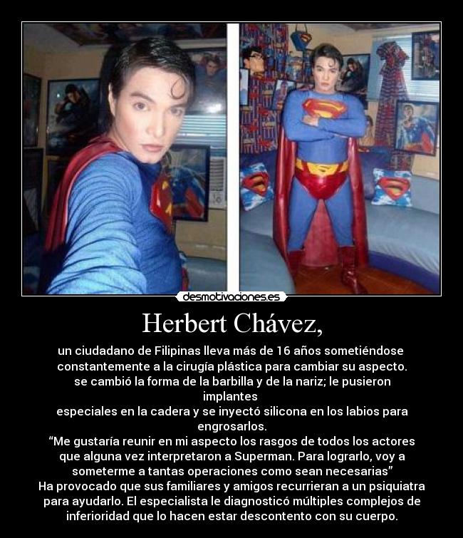 Herbert Chávez, - un ciudadano de Filipinas lleva más de 16 años sometiéndose
constantemente a la cirugía plástica para cambiar su aspecto.
se cambió la forma de la barbilla y de la nariz; le pusieron
implantes
especiales en la cadera y se inyectó silicona en los labios para
engrosarlos.
“Me gustaría reunir en mi aspecto los rasgos de todos los actores
que alguna vez interpretaron a Superman. Para lograrlo, voy a
someterme a tantas operaciones como sean necesarias”
Ha provocado que sus familiares y amigos recurrieran a un psiquiatra
para ayudarlo. El especialista le diagnosticó múltiples complejos de
inferioridad que lo hacen estar descontento con su cuerpo.