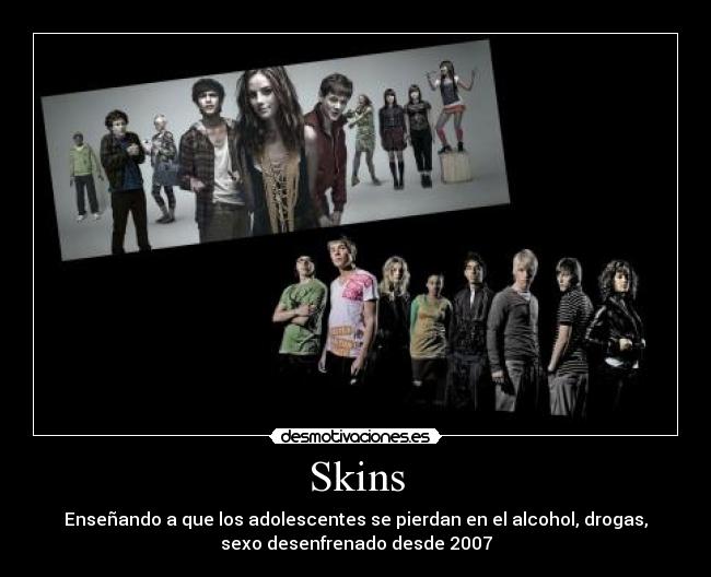 Skins -