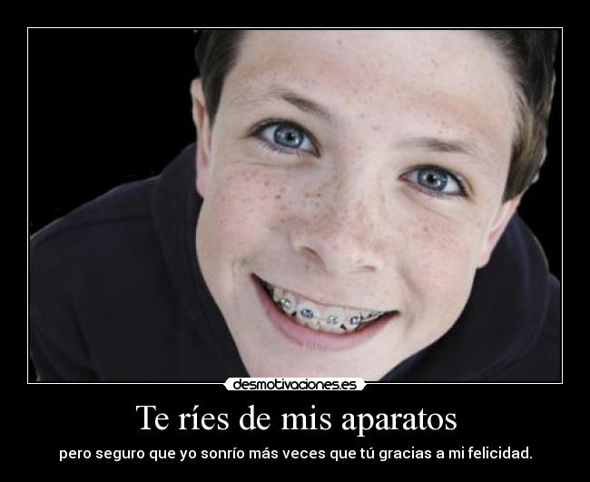 Te ríes de mis aparatos - 