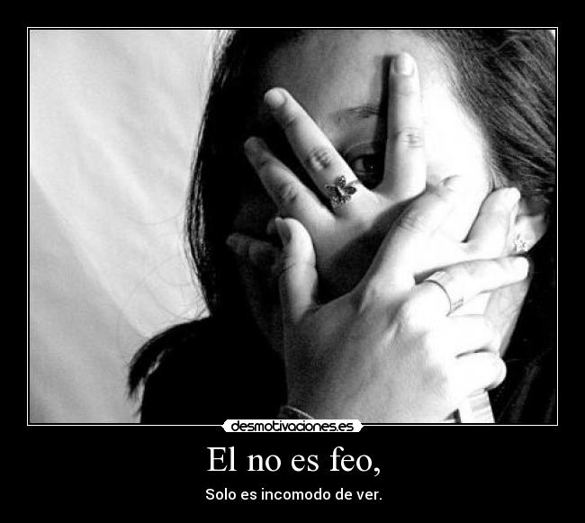 El no es feo, - Solo es incomodo de ver.