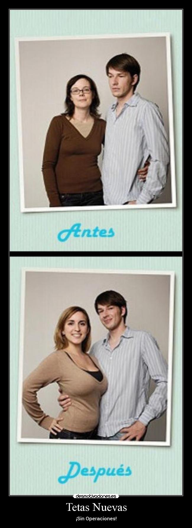 Tetas Nuevas - ¡Sin Operaciones!
