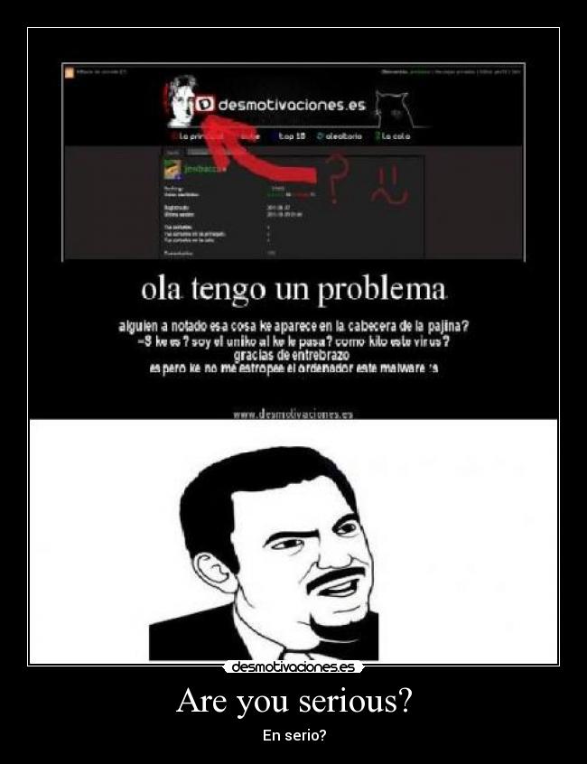 Are you serious? - En serio?