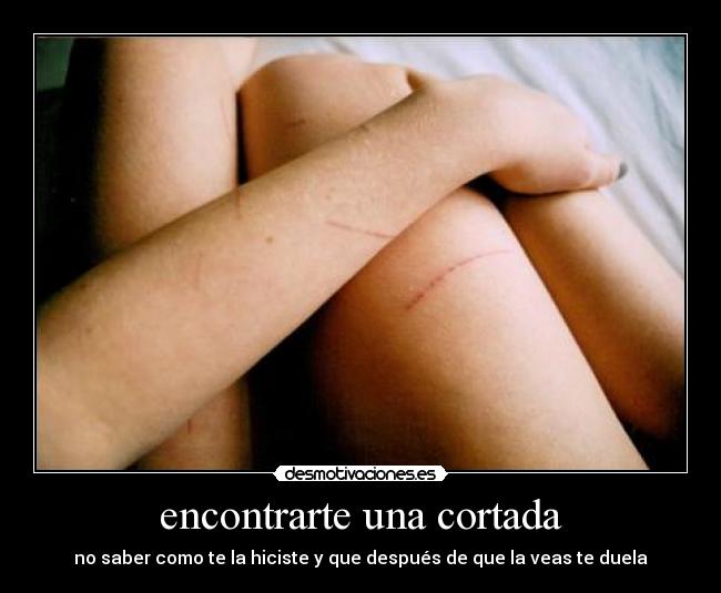 encontrarte una cortada -