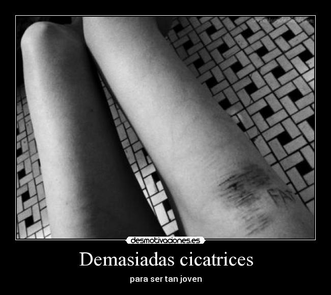 carteles dolor anorexia gorda desmotivaciones