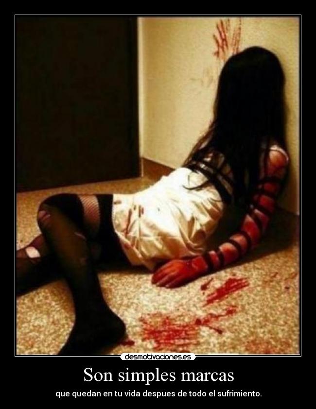 Son simples marcas - que quedan en tu vida despues de todo el sufrimiento.