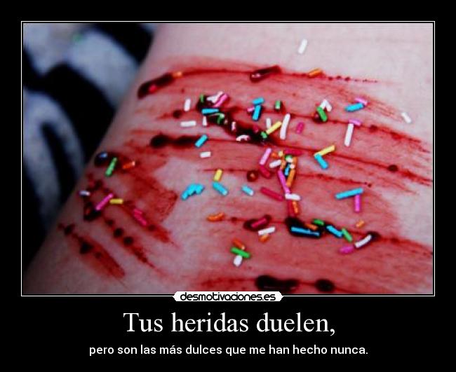 Tus heridas duelen, - pero son las más dulces que me han hecho nunca.