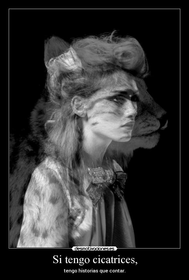 Si tengo cicatrices, - tengo historias que contar.