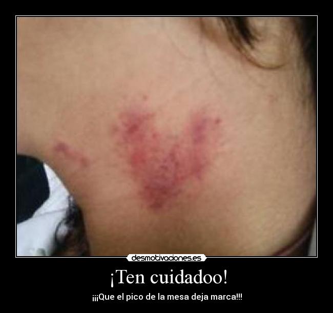 ¡Ten cuidadoo! - ¡¡¡Que el pico de la mesa deja marca!!!