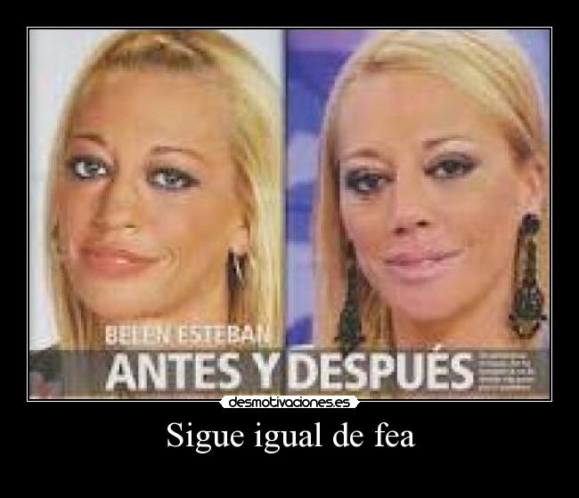 Sigue igual de fea - 