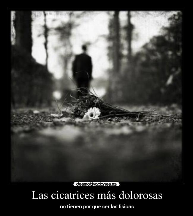 Las cicatrices más dolorosas - no tienen por qué ser las físicas