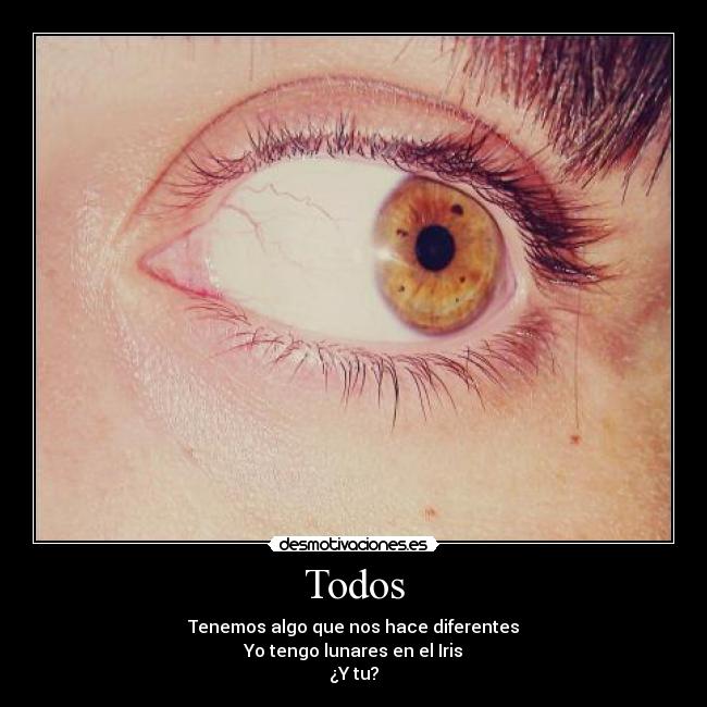 Todos - Tenemos algo que nos hace diferentes
Yo tengo lunares en el Iris
¿Y tu?