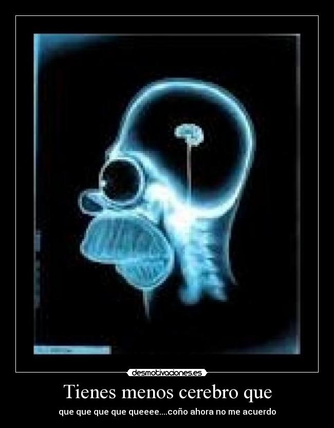 Tienes menos cerebro que - que que que que queeee....coño ahora no me acuerdo