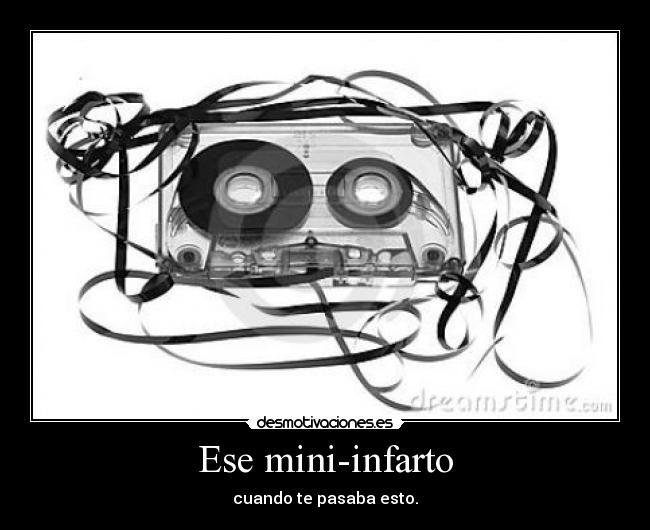 Ese mini-infarto - cuando te pasaba esto.