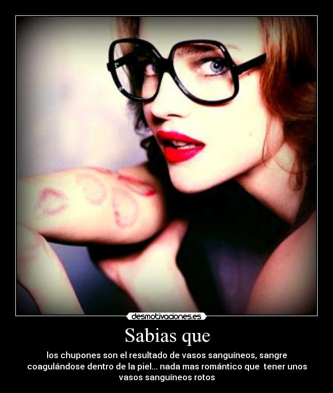 Sabias que - los chupones son el resultado de vasos sanguíneos, sangre
coagulándose dentro de la piel... nada mas romántico que tener unos
vasos sanguíneos rotos