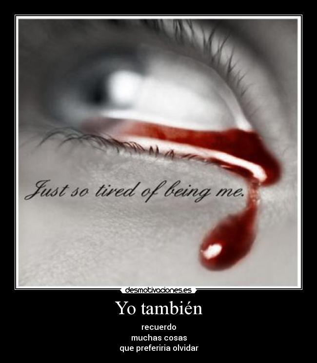 Yo también - recuerdo
muchas cosas
que preferiria olvidar