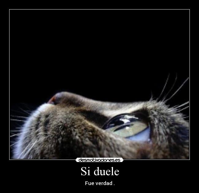 Si duele - Fue verdad .