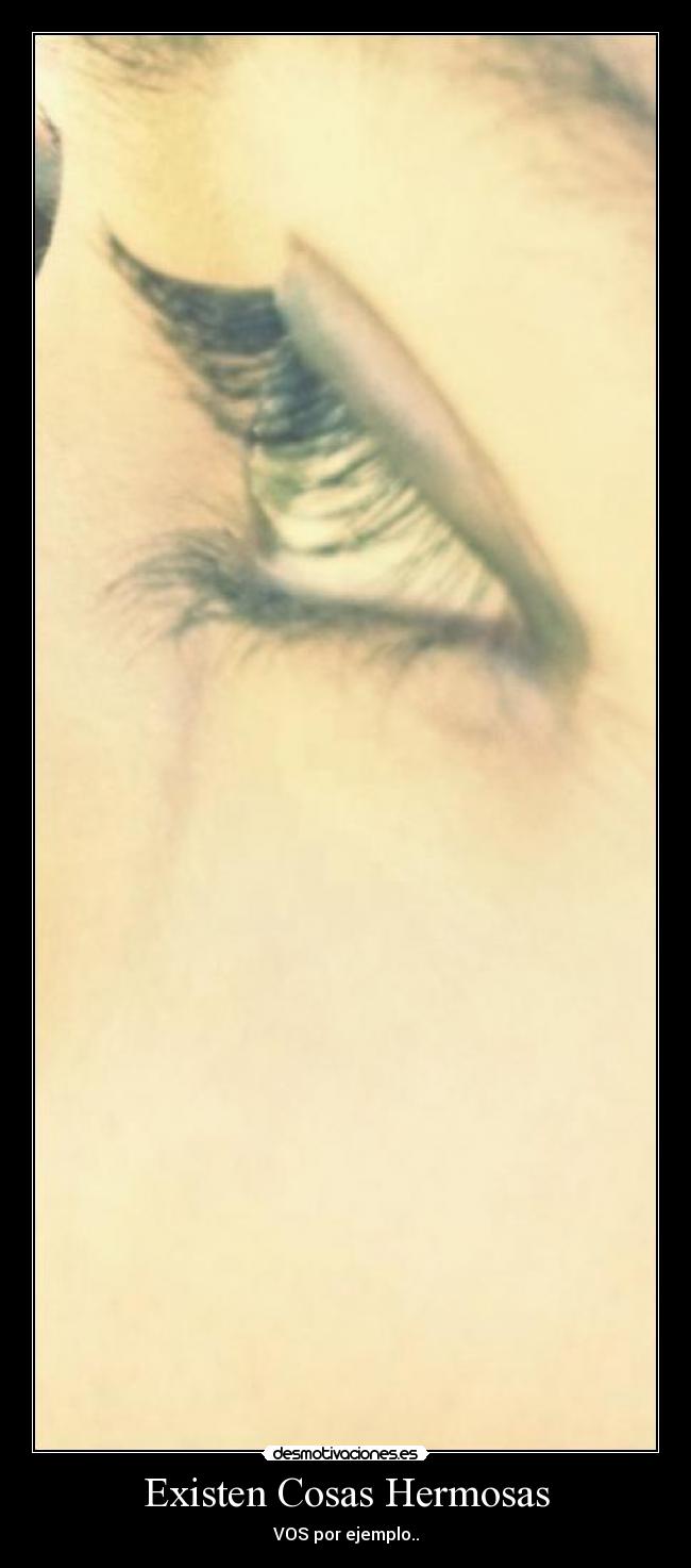 Existen Cosas Hermosas - VOS por ejemplo..