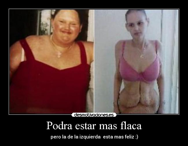 Podra estar mas flaca -