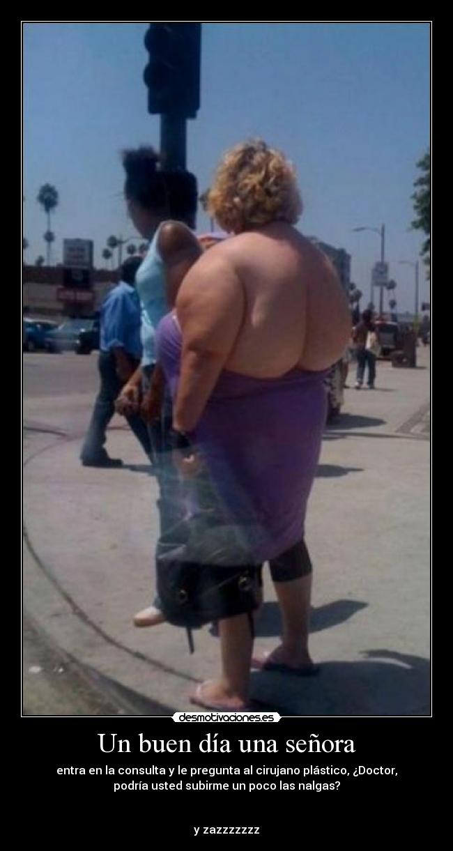 Un buen día una señora - entra en la consulta y le pregunta al cirujano plástico, ¿Doctor,
podría usted subirme un poco las nalgas?
y zazzzzzzz