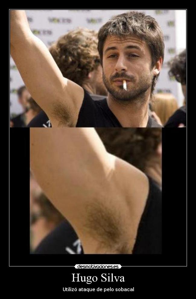 Hugo Silva - Utilizó ataque de pelo sobacal