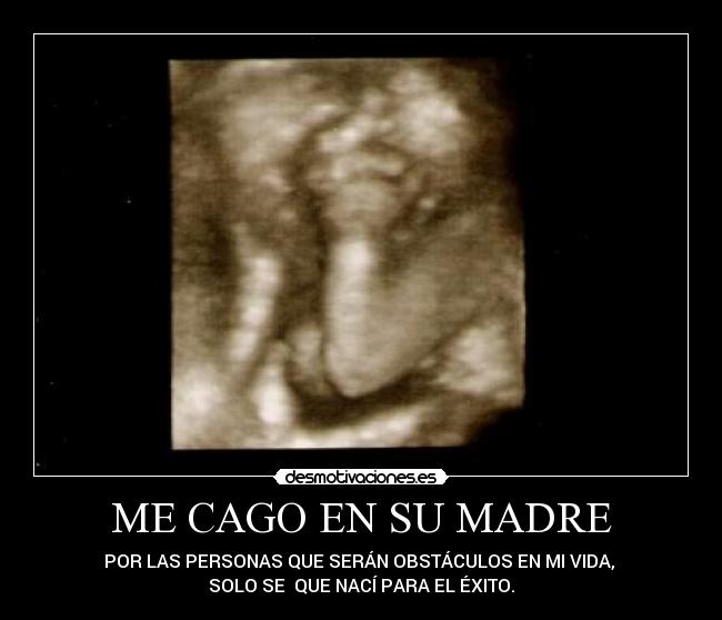 ME CAGO EN SU MADRE - 