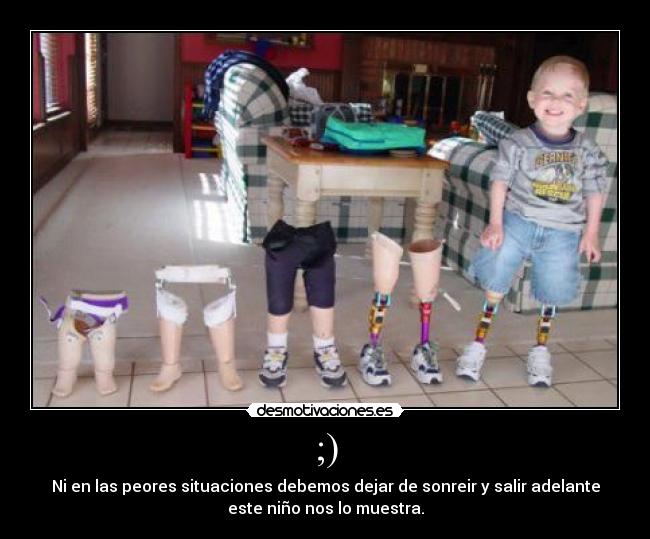 ;) - Ni en las peores situaciones debemos dejar de sonreir y salir adelante
este niño nos lo muestra.